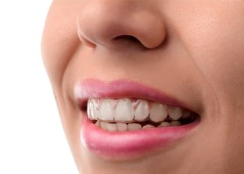 woman wearing clear correct aligner