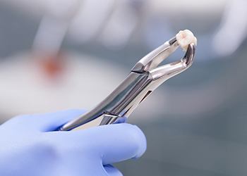 forceps holding a tooth