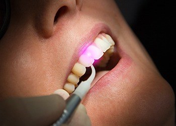 Patient receiving soft tissue laser dentistry treatment