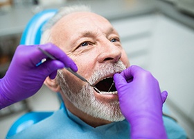 dentist examining a patient’s mouth