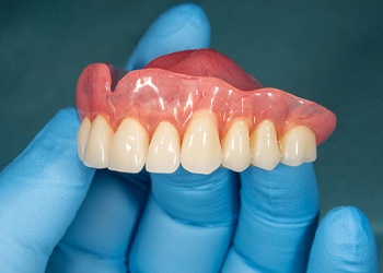 An up-close look at a gloved hand holding an upper full denture