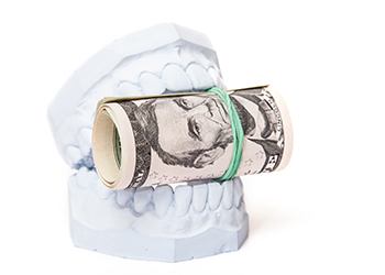 a plaster cast of teeth biting down on a roll of cash