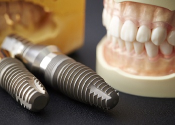 An image of two dental implants and a mouth mold on a table