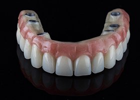 a dental implant supported denture pictured against a black background