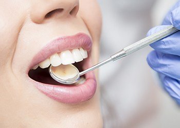 Closeup of patient during dental exam after metal free dental restorations