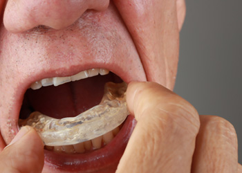 An older man putting a nightguard in his mouth