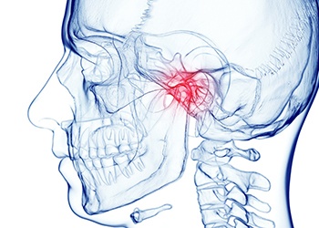 Illustration of the TMJ