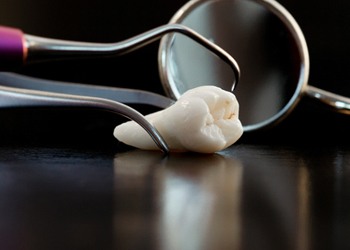 Extracted tooth resting next to dental instruments