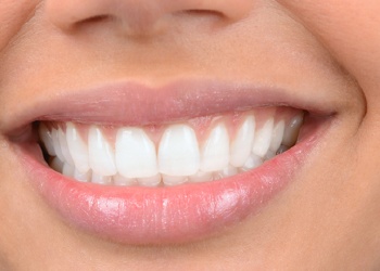 Closeup of beautiful smile after porcelain veneers