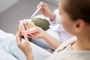 dentist showing a model of dental implants to a patient 