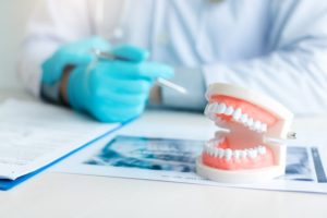 a dentist showing a replica of dentures to explain lower slippage