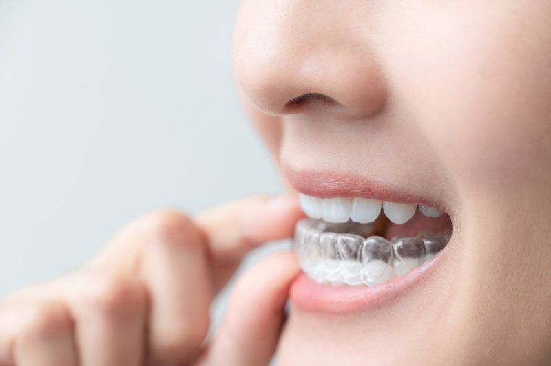 Patient putting on one ClearCorrect aligner