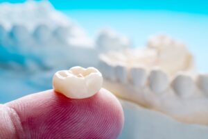 Tooth-colored dental crown on fingertip with model teeth in background